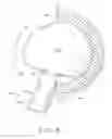 Fig. 09 - Prosthetic hip implants
