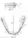 Fig. 09 - Method and system for enhanced orthodontic treatment planning