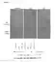 Fig. 08 - Methods for the identification of agents that inhibit mesenchymal-like tumor cells or their formation