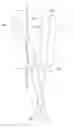 Fig. 01 - Automatic Toilet Seat Assembly Closing System