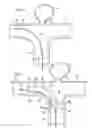 Fig. 02 - ENDOVASCULAR PROSTHESIS