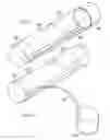 Fig. 04 - ENDOVASCULAR PROSTHESIS