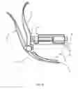 Fig. 09 - Guitar Capo With Rotatable Member
