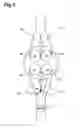 Fig. 04 - HOMOGENEOUS CHARGE COMPRESSION IGNITION ENGINE