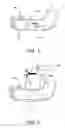 Fig. 02 - Apparatus, system, and method for medical structure embellishments