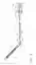 Fig. 06 - Pneumatically powered surgical cutting and fastening instrument with a variable control of the actuating rate of firing with mechanical power assist