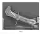 Fig. 07 - Method of making hydrophilic fluoropolymer material