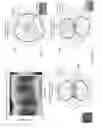 Fig. 50 - Balanced metamaterial antenna device