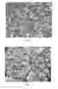 Fig. 02 - TANTALUM POWDER, METHOD FOR PREPARING THE SAME, AND ELECTROLYTIC CAPACITOR ANODE MADE OF THE TANTALUM POWDER