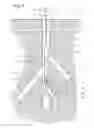 Fig. 04 - Tool for locating and plugging lateral wellbores