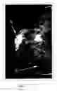 Fig. 06 - Mammography/tomosynthesis systems and methods automatically deriving breast characteristics from breast x-ray images and automatically adjusting image processing parameters accordingly