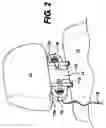 Fig. 03 - Headrest sound system