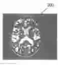 Fig. 01 - IDENTIFICATION AND VISUALIZATION OF REGIONS OF INTEREST IN MEDICAL IMAGING