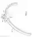 Fig. 06 - Alignment device for gas turbine casings