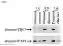 Fig. 02 - Methods of inhibiting photoreceptor apoptosis