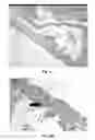 Fig. 06 - Neural scaffolds