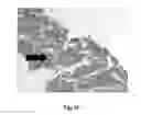 Fig. 07 - Neural scaffolds