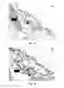Fig. 08 - Neural scaffolds