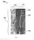 Fig. 07 - Method for modifying the wettability and/or other biocompatibility characteristics of a surface of a biological material by the application of gas cluster ion beam technology and biological materials made thereby