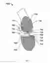 Fig. 08 - Method for modifying the wettability and/or other biocompatibility characteristics of a surface of a biological material by the application of gas cluster ion beam technology and biological materials made thereby