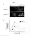 Fig. 02 - PHARMACEUTICAL COMPOSITION FOR PREVENTING AND TREATING RESTENOSIS COMPRISING PEROXIREDOXIN 2 PROTEIN AS AN ACTIVE INGREDIENT AND COMPOSITION FOR SCREENING THERAPEUTICS OF RESTENOSIS COMPRISING PEROXIREDOXIN 2 GENE OR ITS PROTEIN PRODUCT, AND METHOD FOR SCREENING TH