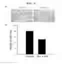 Fig. 07 - PHARMACEUTICAL COMPOSITION FOR PREVENTING AND TREATING RESTENOSIS COMPRISING PEROXIREDOXIN 2 PROTEIN AS AN ACTIVE INGREDIENT AND COMPOSITION FOR SCREENING THERAPEUTICS OF RESTENOSIS COMPRISING PEROXIREDOXIN 2 GENE OR ITS PROTEIN PRODUCT, AND METHOD FOR SCREENING TH