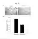 Fig. 09 - PHARMACEUTICAL COMPOSITION FOR PREVENTING AND TREATING RESTENOSIS COMPRISING PEROXIREDOXIN 2 PROTEIN AS AN ACTIVE INGREDIENT AND COMPOSITION FOR SCREENING THERAPEUTICS OF RESTENOSIS COMPRISING PEROXIREDOXIN 2 GENE OR ITS PROTEIN PRODUCT, AND METHOD FOR SCREENING TH