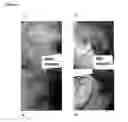 Fig. 03 - Compositions for promoting wound healing and treating psoriasis