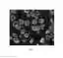 Fig. 08 - Method of Detection of Fluorescence-Labeled Probes Attached to Diseased Solid Tissue