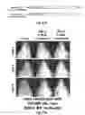 Fig. 40 - Herpes simplex virus mutant ICP0