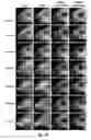 Fig. 41 - Herpes simplex virus mutant ICP0