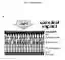 Fig. 06 - Protein-based artificial retinas