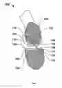 Fig. 08 - Method for modifying the wettability and/or other biocompatibility characteristics of a surface of a biological material by the application of gas cluster ion beam technology and biological materials made thereby