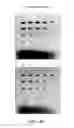 Fig. 05 - DETECTION OF IMMOBILIZED NUCLEIC ACID