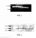 Fig. 02 - Diagnosing pneumococcal pneumonia