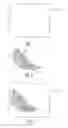 Fig. 02 - Method of molding a breast-receiving cup for a garment