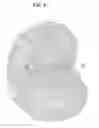 Fig. 09 - Topography linked golf aid