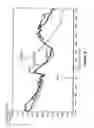 Fig. 08 - Insulin formulations for rapid uptake