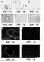 Fig. 02 - Methods for increasing vascular density and maintaining viability of microvascular endothelial cells using trk receptor ligands