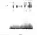 Fig. 02 - C-substituted diindolylmethane compositions and methods for the treatment of multiple cancers