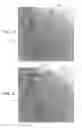 Fig. 03 - CONTROLLED ACTUATION AND DEPLOYMENT OF A MEDICAL DEVICE