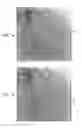 Fig. 04 - CONTROLLED ACTUATION AND DEPLOYMENT OF A MEDICAL DEVICE