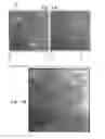 Fig. 09 - CONTROLLED ACTUATION AND DEPLOYMENT OF A MEDICAL DEVICE