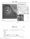 Fig. 12 - CONTROLLED ACTUATION AND DEPLOYMENT OF A MEDICAL DEVICE