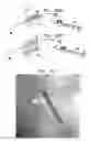 Fig. 16 - CONTROLLED ACTUATION AND DEPLOYMENT OF A MEDICAL DEVICE