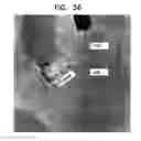 Fig. 25 - CONTROLLED ACTUATION AND DEPLOYMENT OF A MEDICAL DEVICE