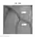 Fig. 27 - CONTROLLED ACTUATION AND DEPLOYMENT OF A MEDICAL DEVICE