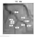 Fig. 28 - CONTROLLED ACTUATION AND DEPLOYMENT OF A MEDICAL DEVICE