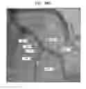 Fig. 29 - CONTROLLED ACTUATION AND DEPLOYMENT OF A MEDICAL DEVICE