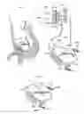 Fig. 02 - Implantable device for external urinary control